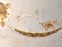 Image of Closterium dianae