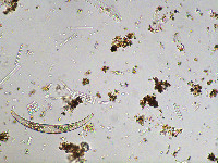 Closterium dianae var. brevius image