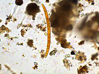 Image of Closterium lineatum