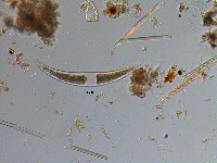 Image of Closterium moniliferum