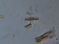 Image of Closterium navicula