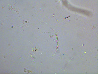 Closterium parvulum image