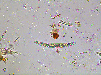 Image of Closterium planum