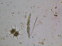 Closterium striolatum image