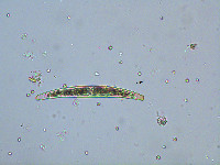 Closterium striolatum image