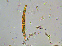 Image of Closterium striolatum