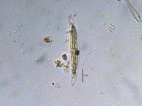 Closterium tumidulum image