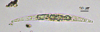 Closterium nylandicum image