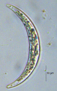 Image of Closterium venus