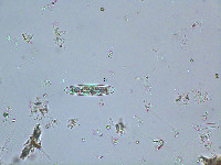 Closterium closteroides image