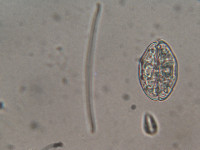 Cosmarium pseudotaxichondrum image