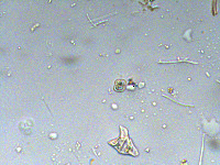 Cosmarium angulosum f. rotundatum image