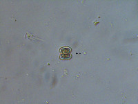 Cosmarium asphaerosporum var. strigosum image