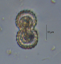 Image of Cosmarium isthmium