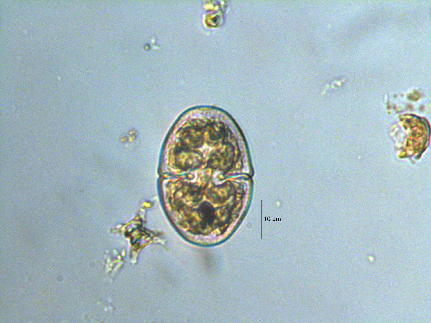 Cosmarium microsphinctum image