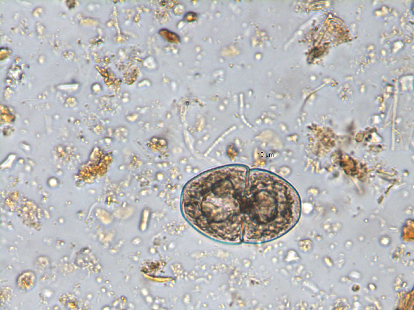 Cosmarium pseudopyramidatum image