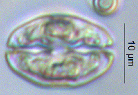 Image of Cosmarium pseudotaxichondrum