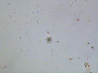 Cosmarium trilobulatum image