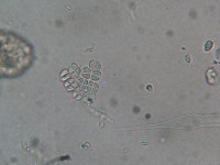 Image of Willea apiculata