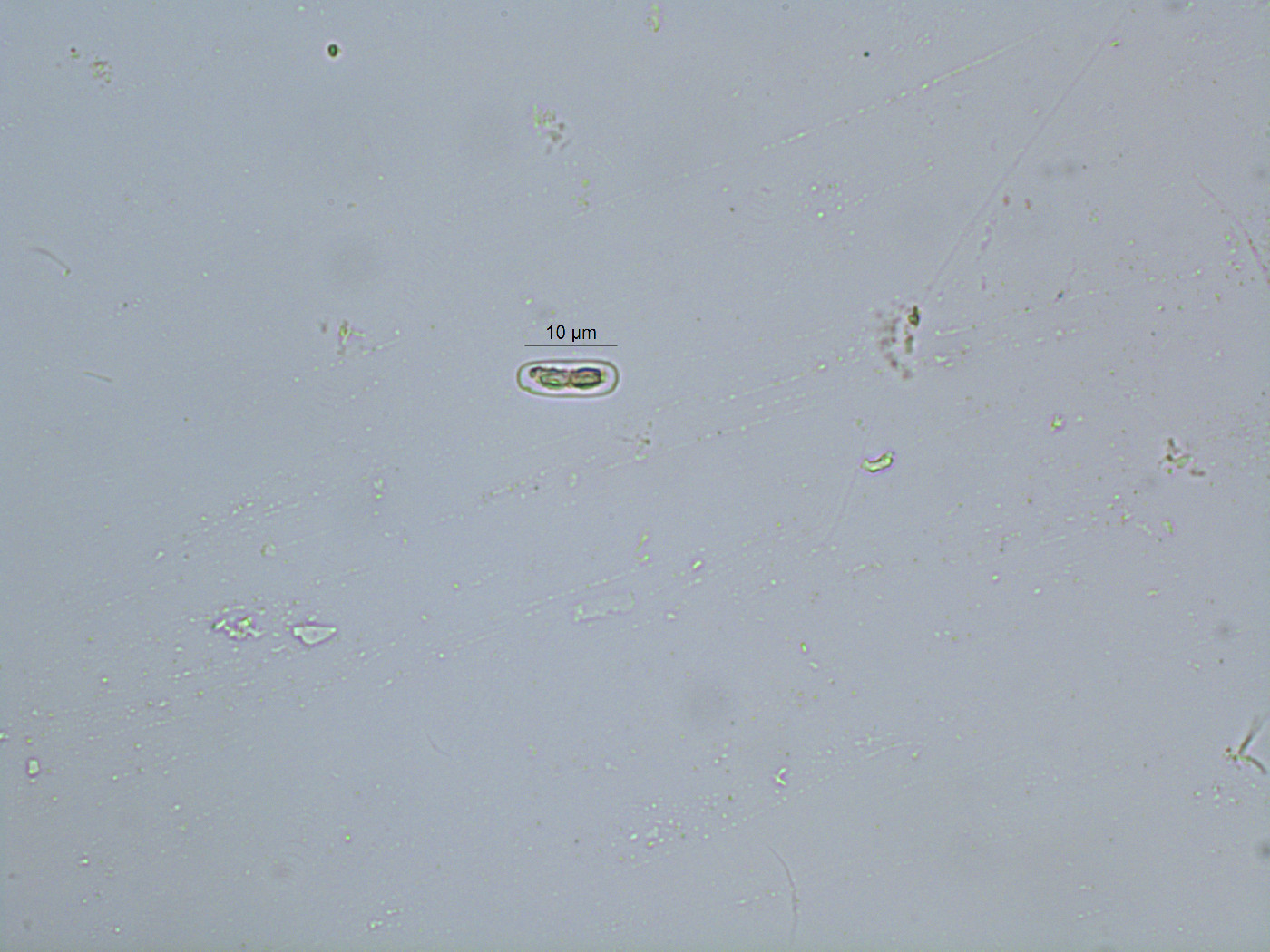 Cylindrocystis image