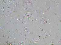 Dictyosphaerium ehrenbergianum image