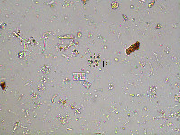 Image of Mucidosphaerium pulchellum