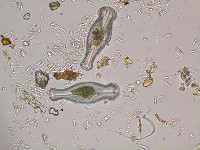 Image of Didymosphenia geminata
