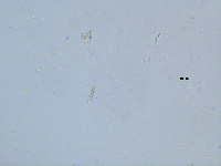 Dinobryon eurystoma image