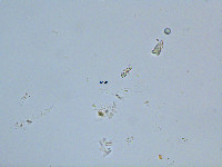 Dinobryon eurystoma image