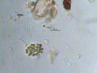 Dinobryon bavaricum image