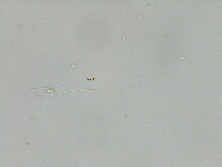 Dinobryon bavaricum image