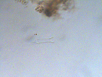 Image of Dinobryon crenulatum