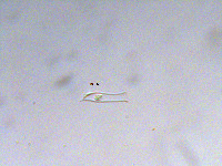 Image of Dinobryon sertularia