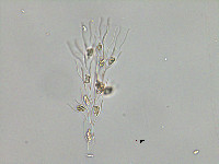 Dinobryon sertularia image