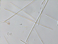 Elakatothrix gelatinosa image
