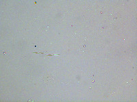Elakatothrix gelatinosa image