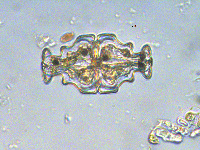 Image of Euastrum ampullaceum