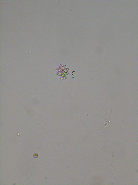 Image of Euastrum cuspidatum