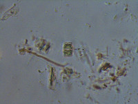 Image of Euastrum dubium