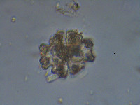 Image of Euastrum verrucosum