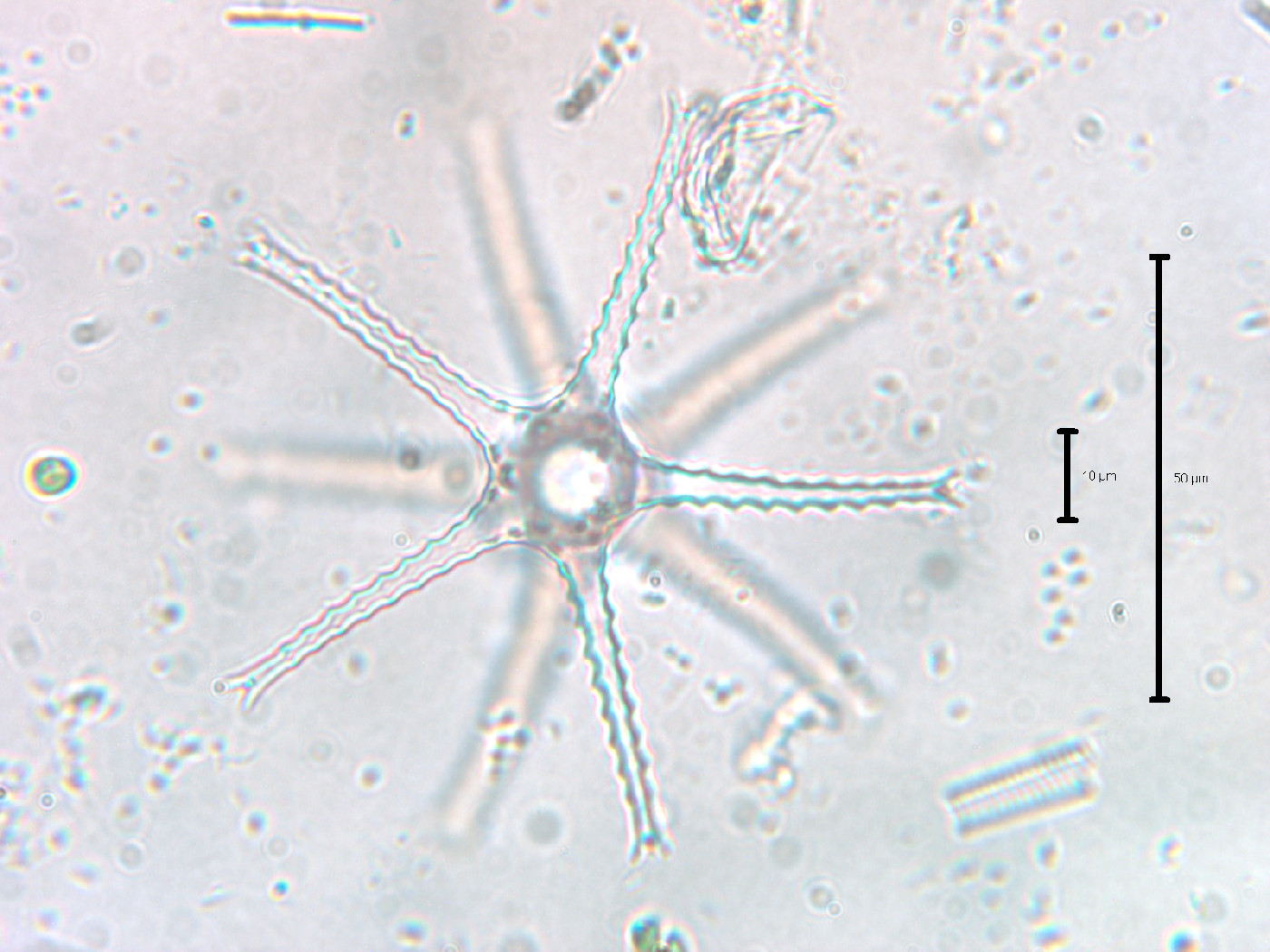 Staurastrum arachne image