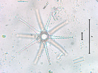 Image of Staurastrum arachne